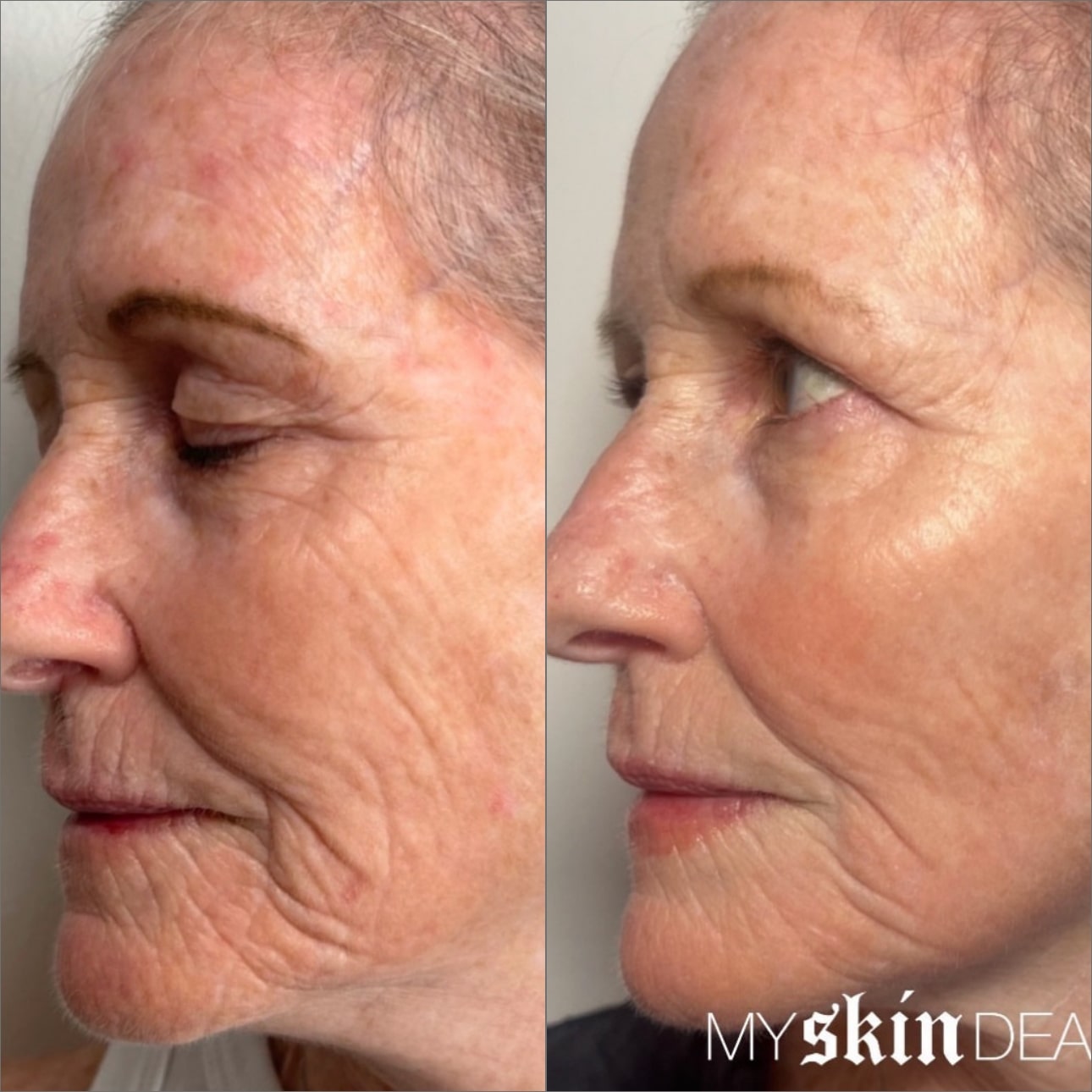 Morpheus Face Boca Raton