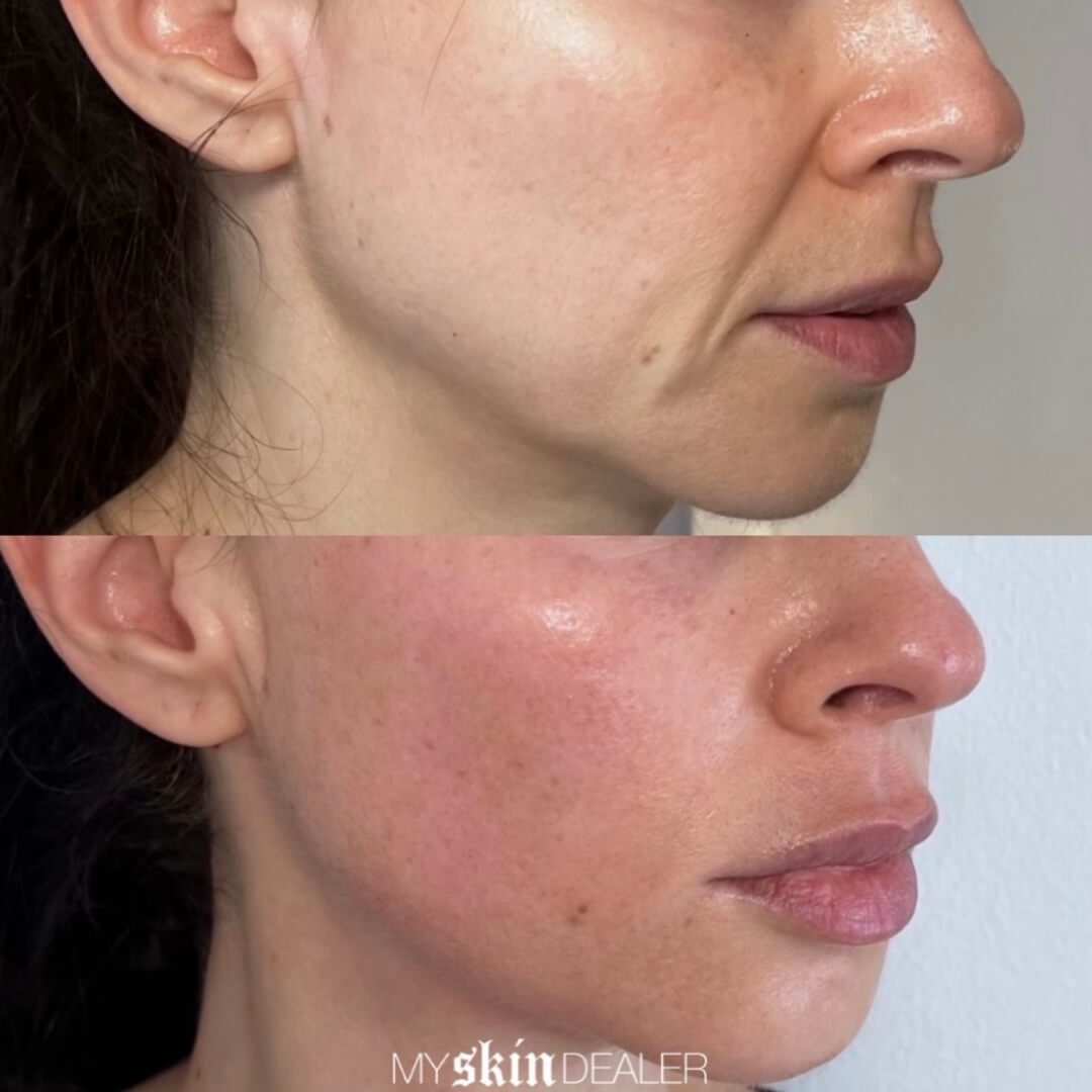 Morpheus Face Boca Raton