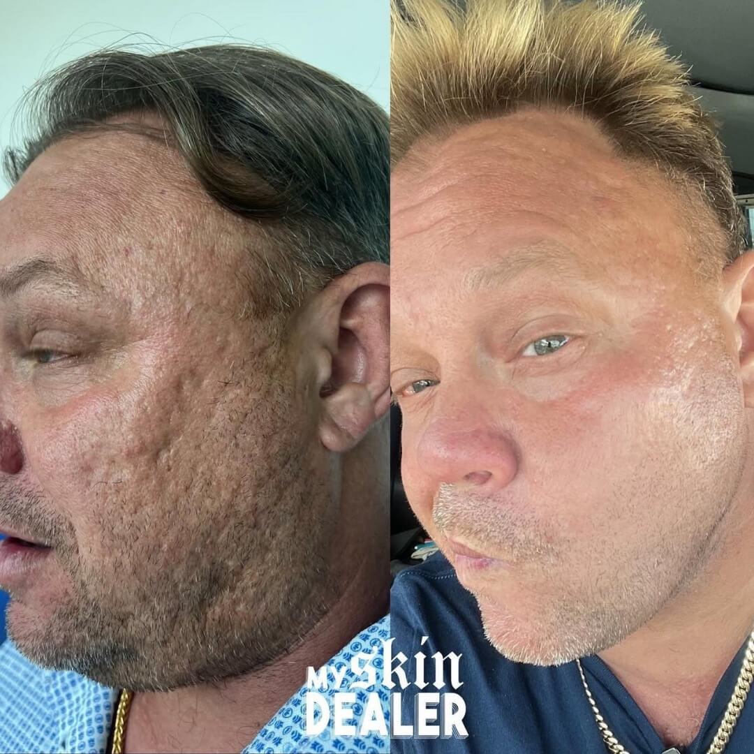 Morpheus Face Boca Raton