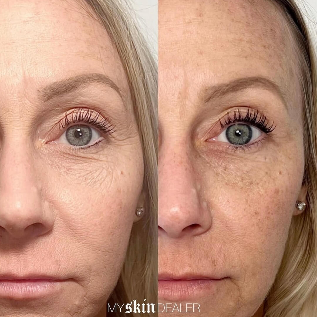 Morpheus Face Boca Raton