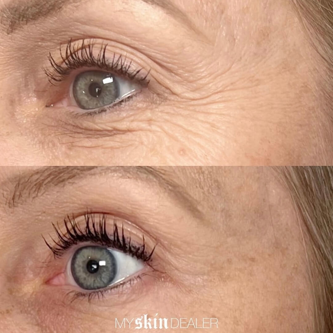 Morpheus Face Boca Raton