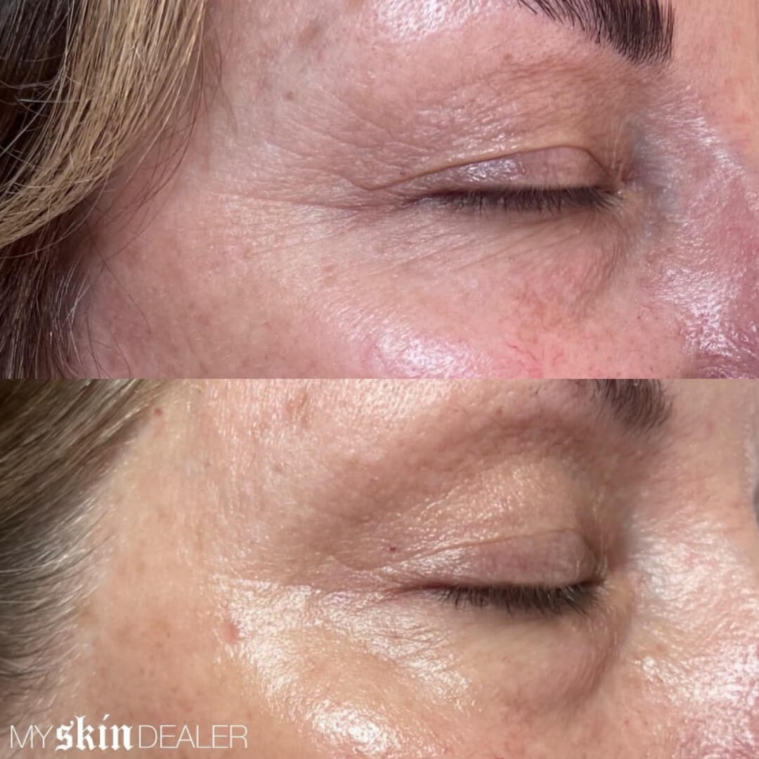 Morpheus Face Boca Raton