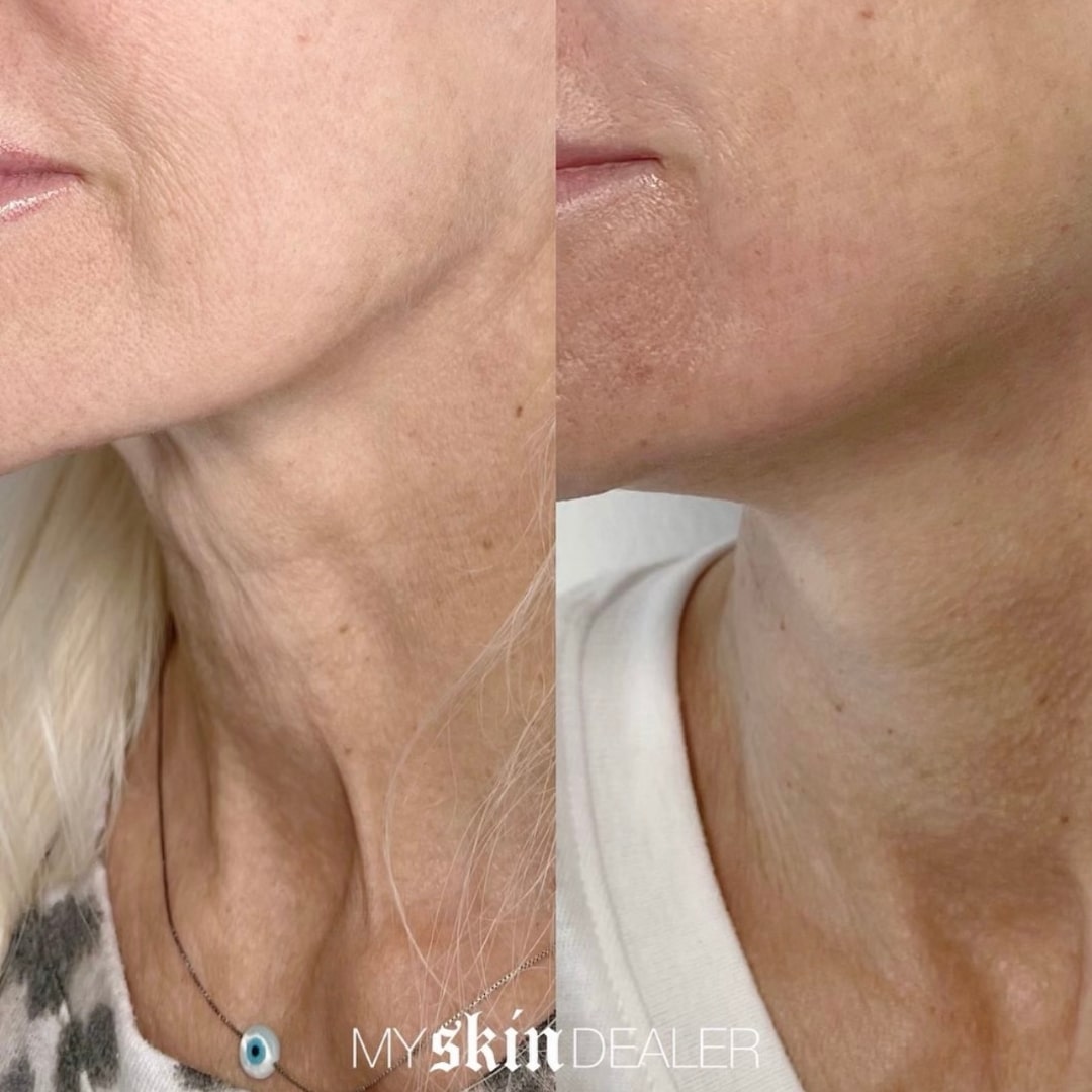 Morpheus Face Boca Raton