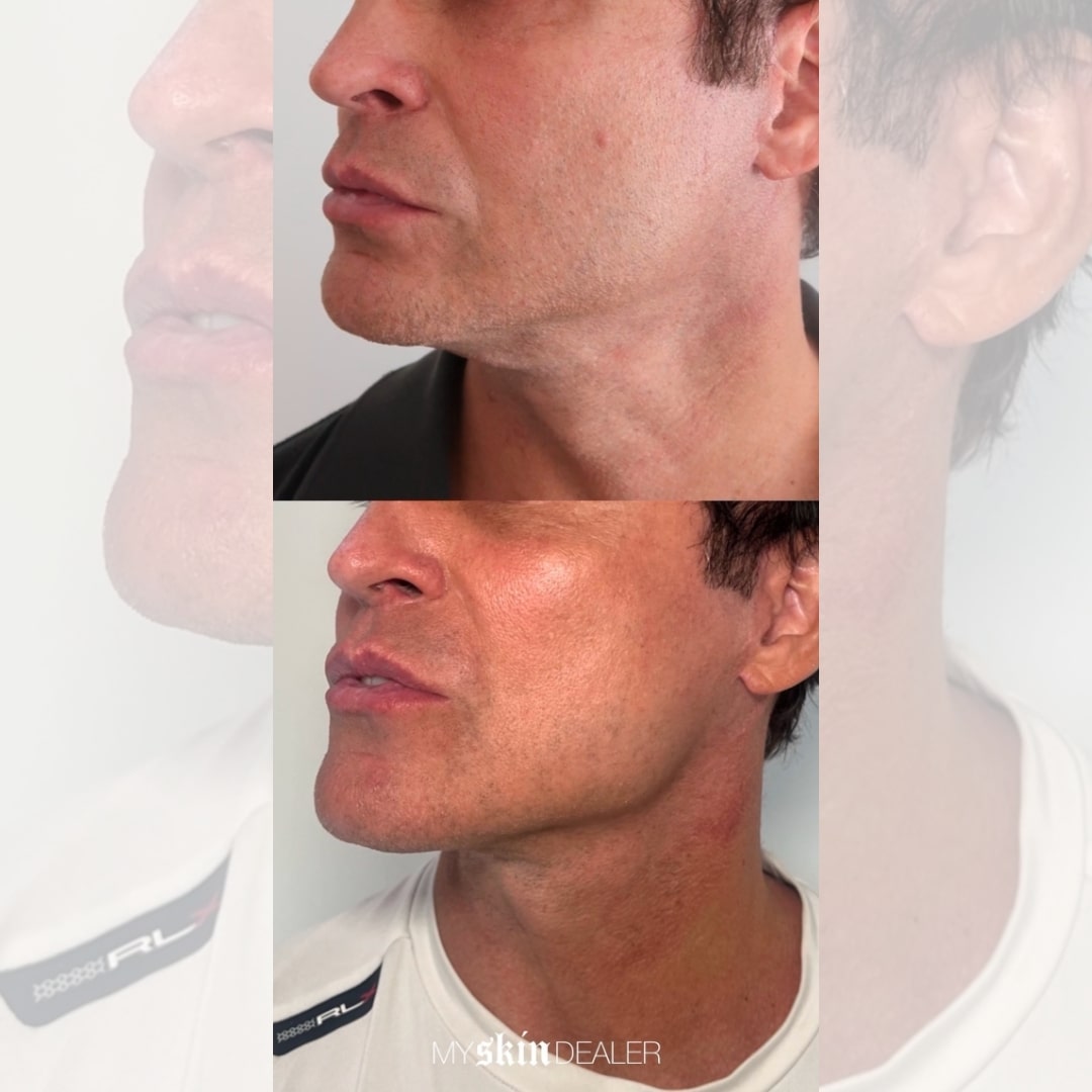 Morpheus Face Boca Raton