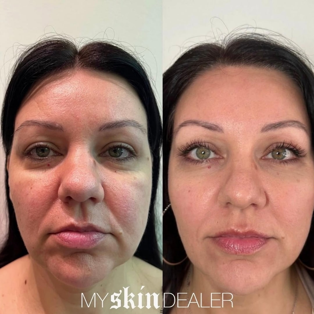 Morpheus Face Boca Raton