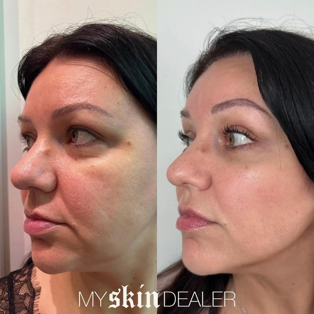 Morpheus Face Boca Raton