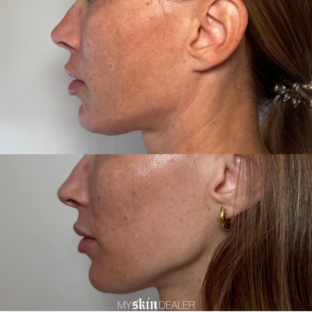 Morpheus Face Boca Raton