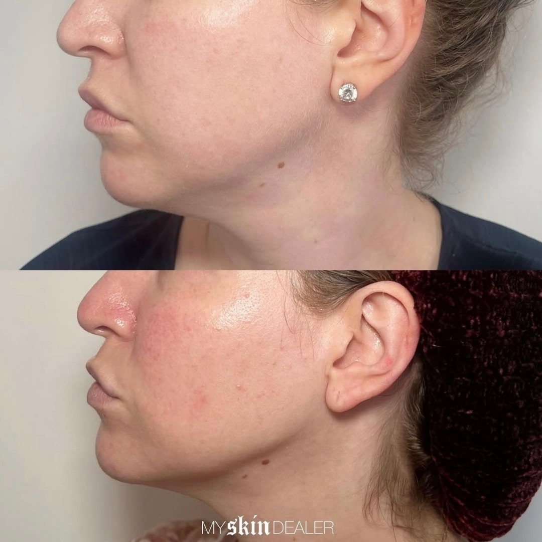 Morpheus Face Boca Raton