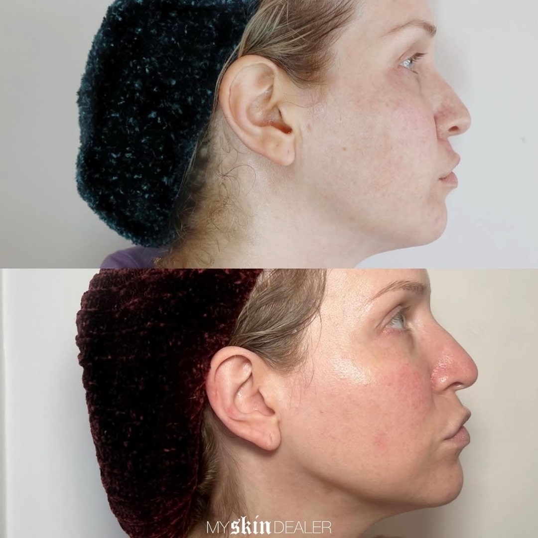 Morpheus Face Boca Raton