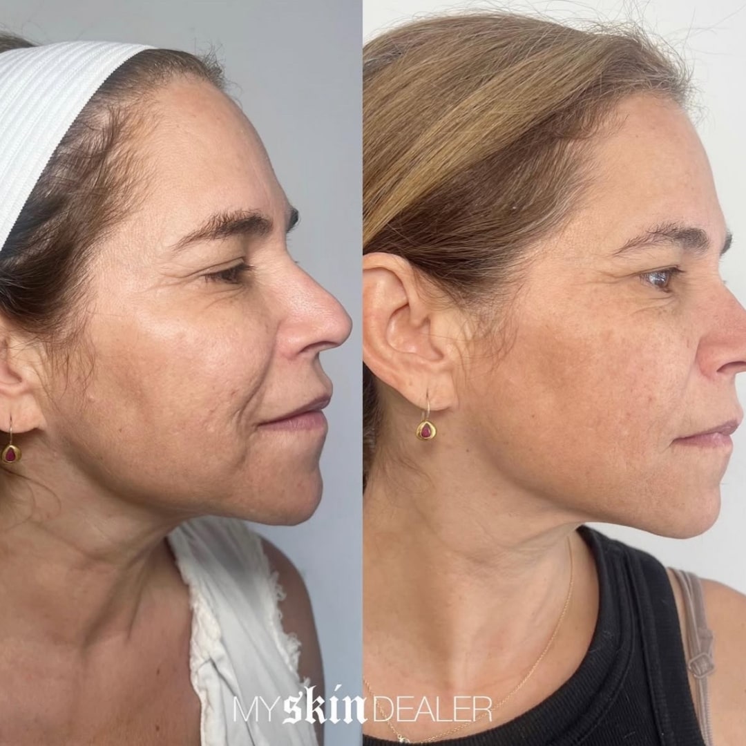 Morpheus Face Boca Raton