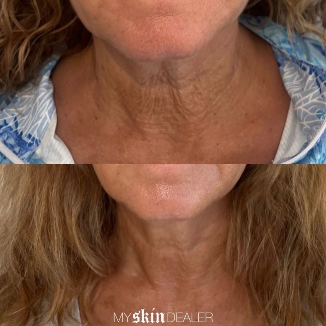 Morpheus Face Boca Raton