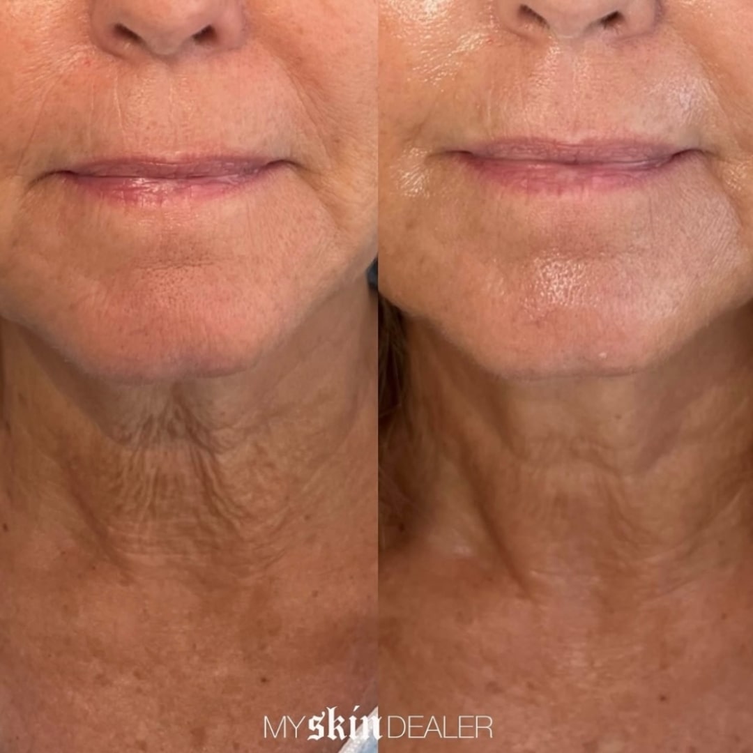 Morpheus Face Boca Raton