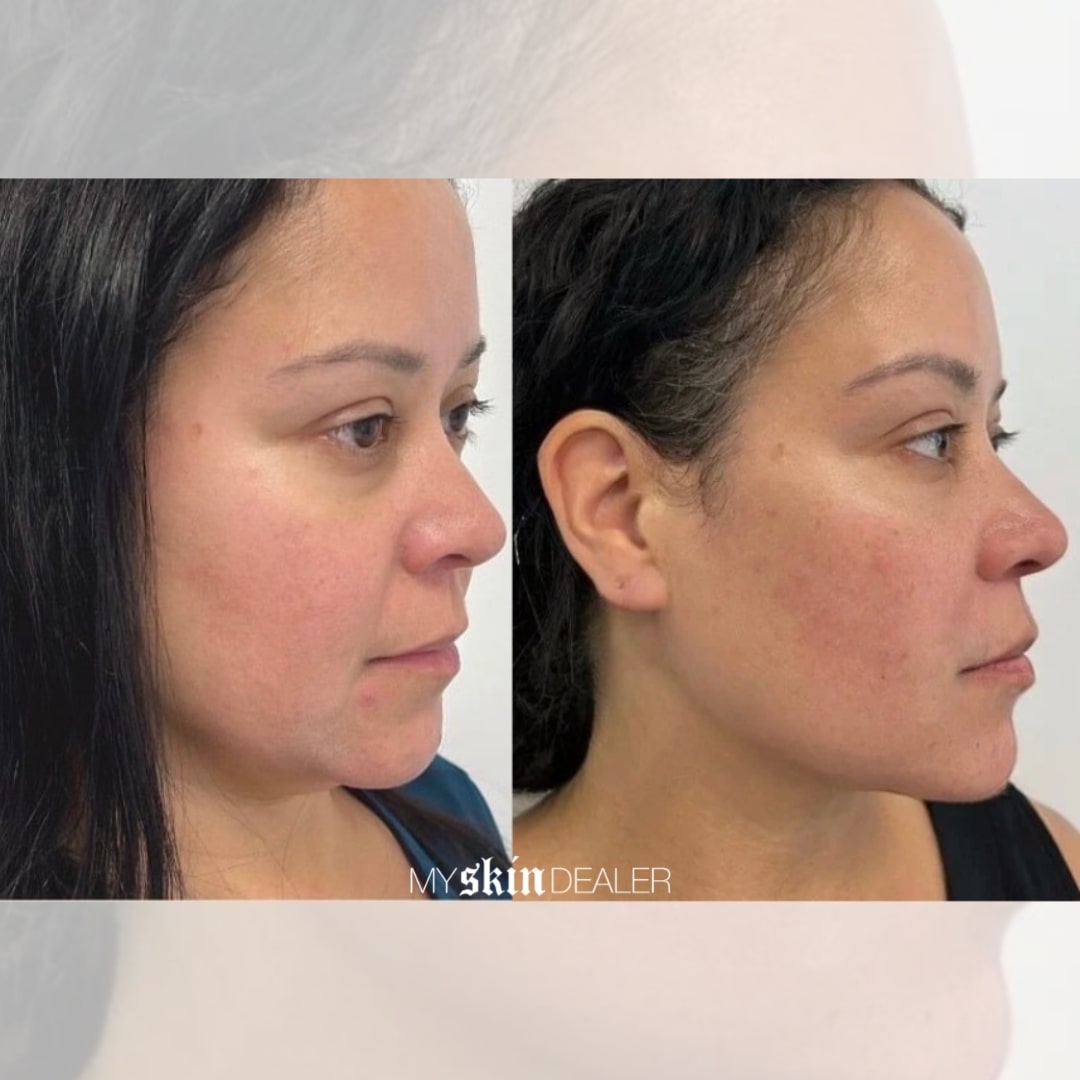 Morpheus Face Boca Raton