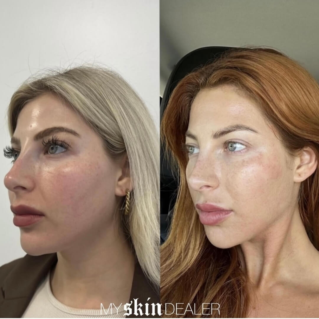 Morpheus Face Boca Raton