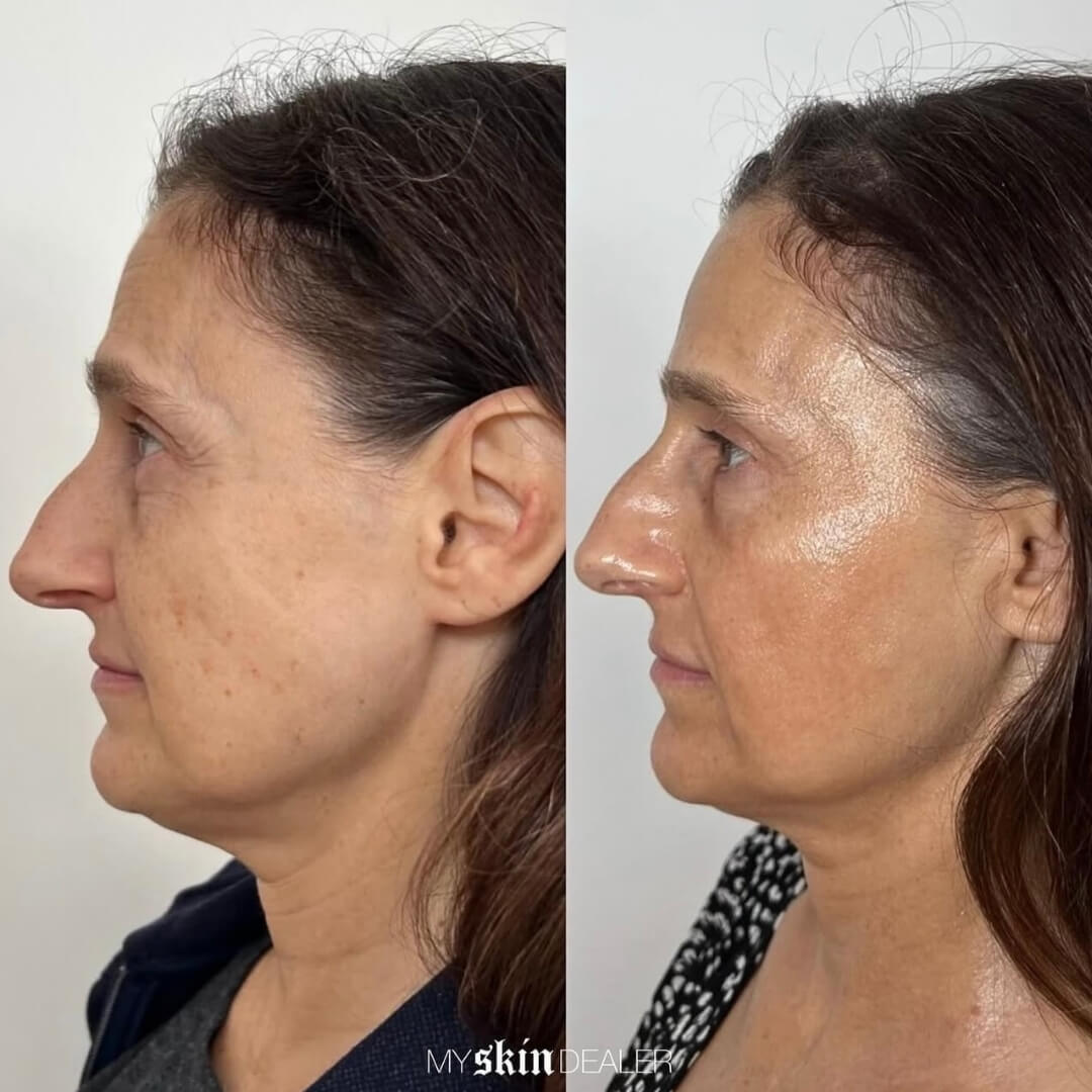 Morpheus Face Boca Raton