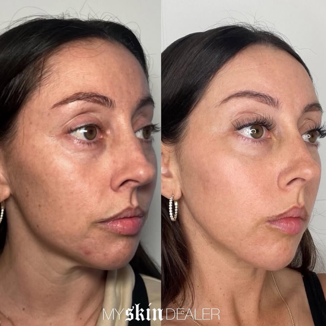 Morpheus Face Boca Raton