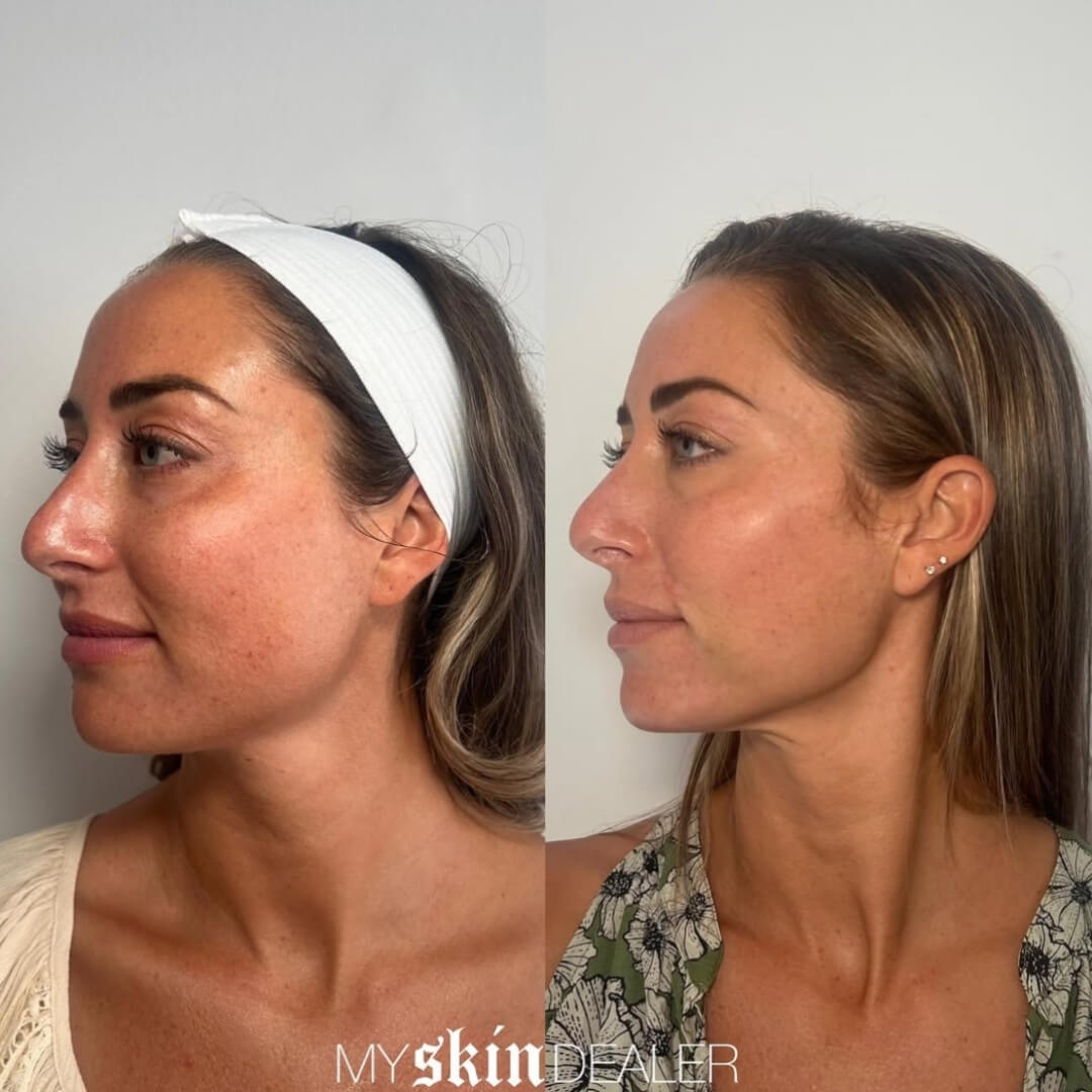 Morpheus Face Boca Raton