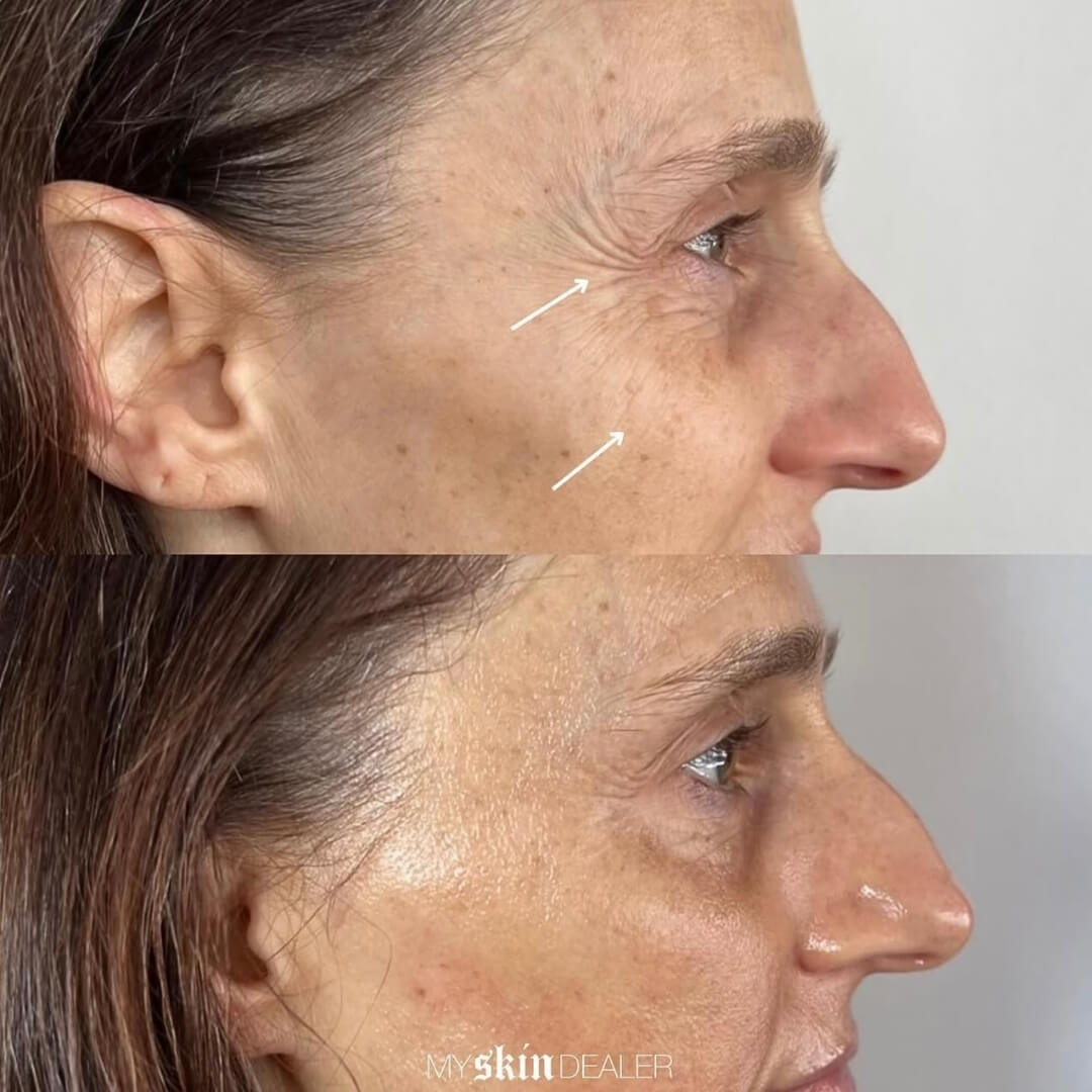 Morpheus Face Boca Raton