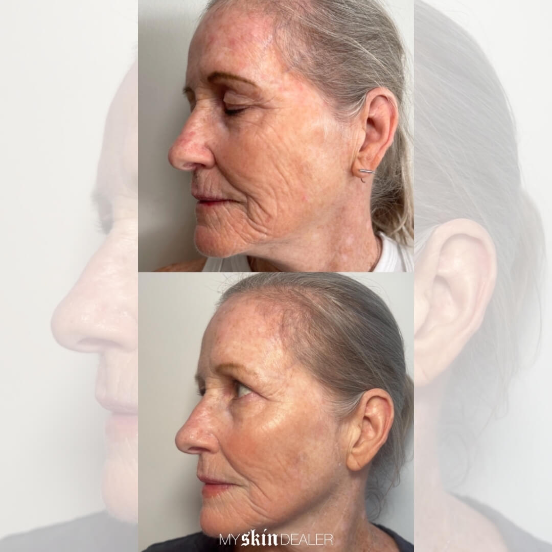 Morpheus Face Boca Raton