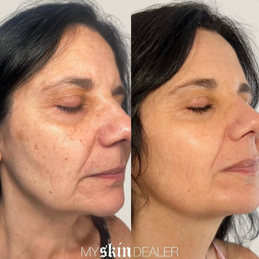 clear-and-brilliant-before-and-after (2).jpg