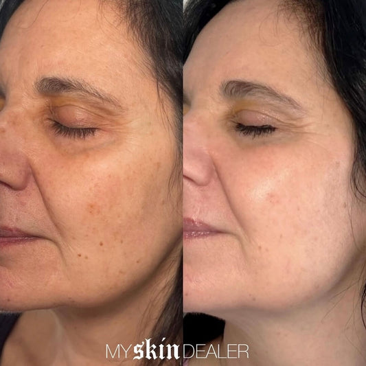 clear-and-brilliant-before-and-after (3).jpg