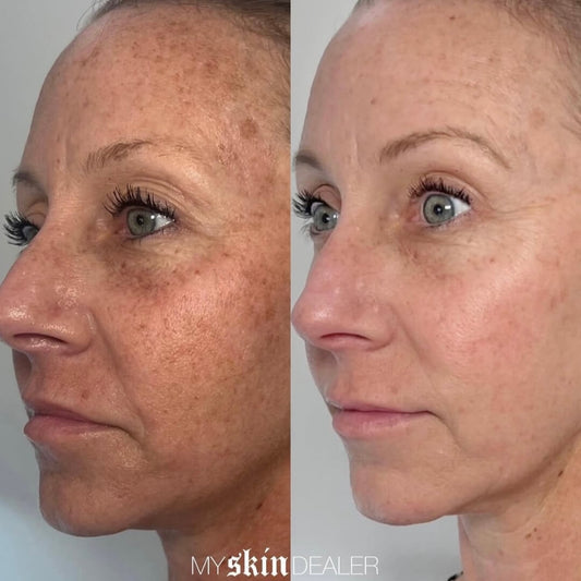 clear-and-brilliant-before-and-after (4).jpg