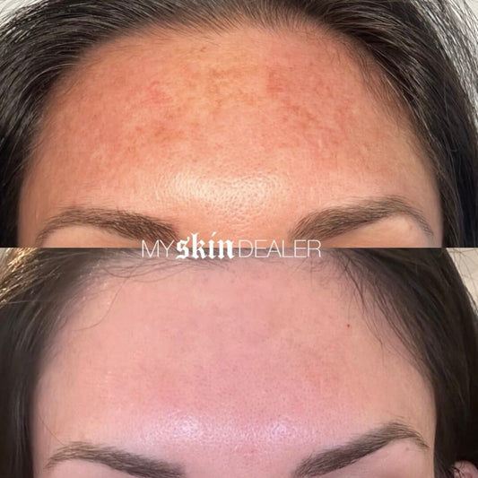 clear-and-brilliant-before-and-after (5).jpg
