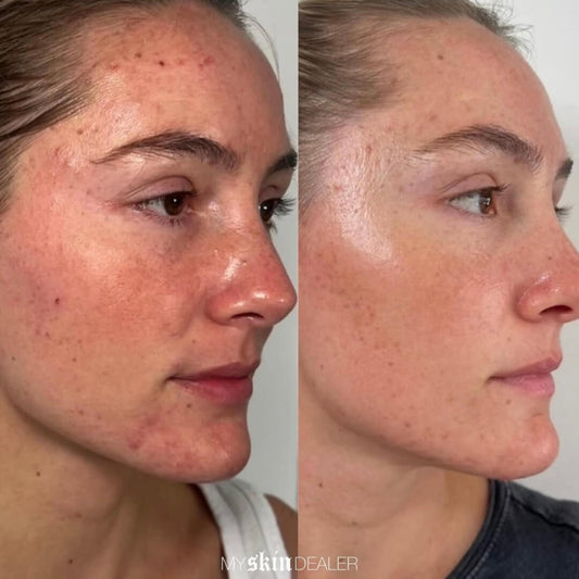 clear-and-brilliant-before-and-after.jpg