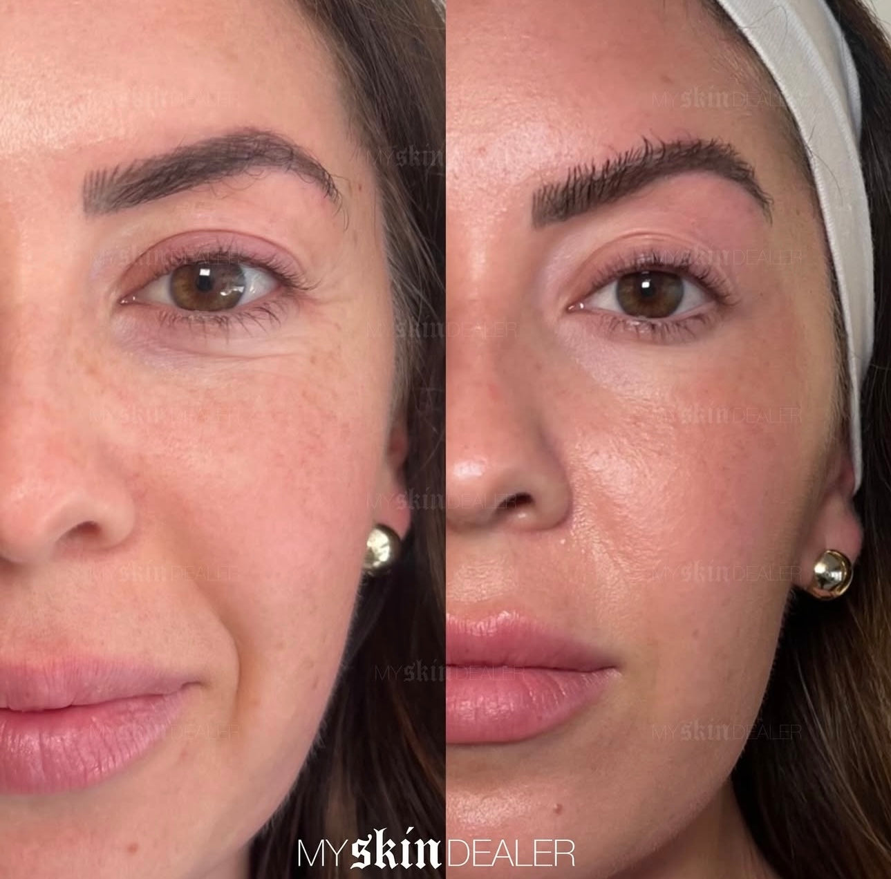 coolpeel.jpeg