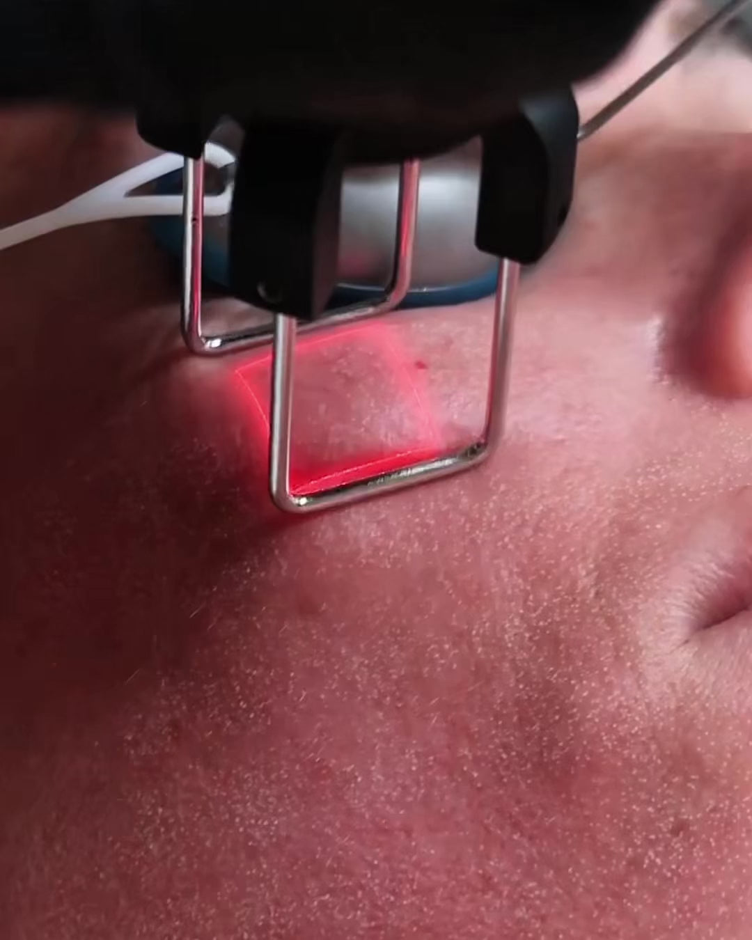 CoolPeel